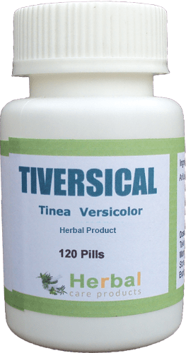 Tinea Versicolor Herbal Treatment