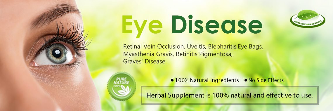 Herbal Supplement for Eye Diseases