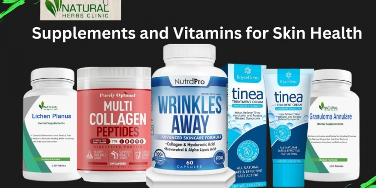 Supplements and Vitamins for Skin Health