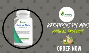 Natural Remedies for Keratosis Pilaris
