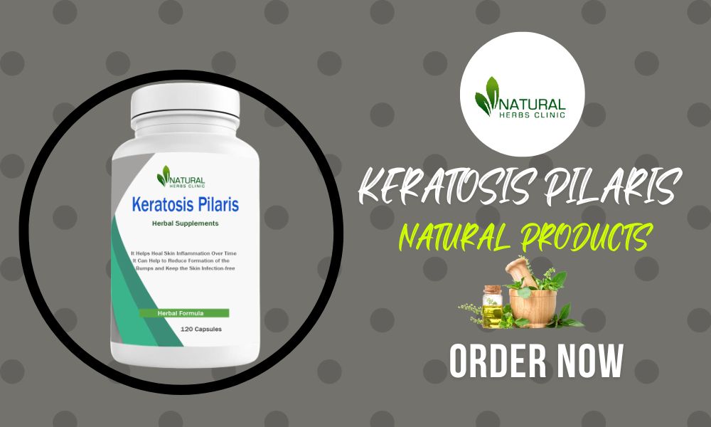 Natural Remedies for Keratosis Pilaris