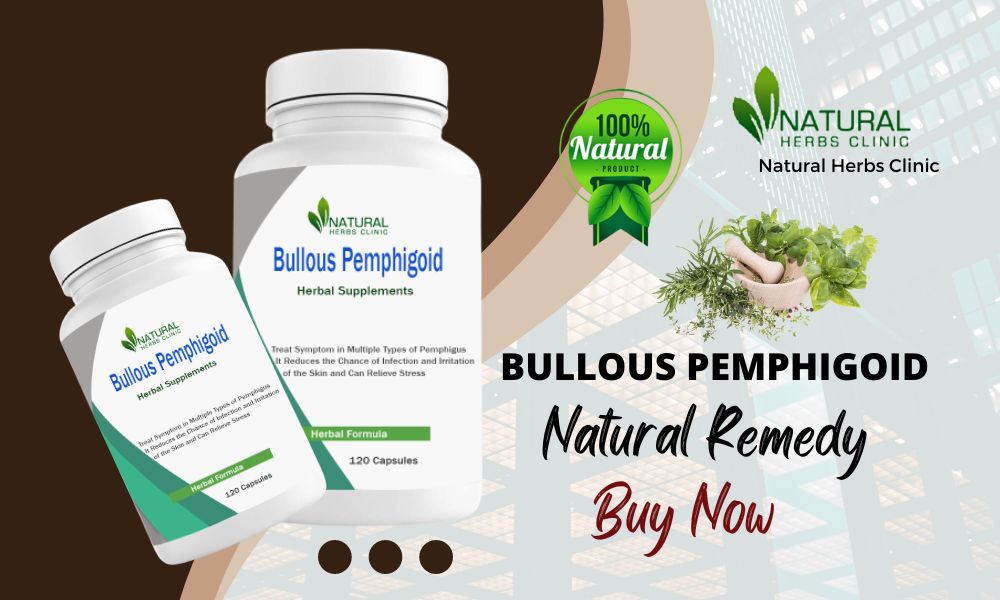 Natural Treatment for Bullous Pemphigoid