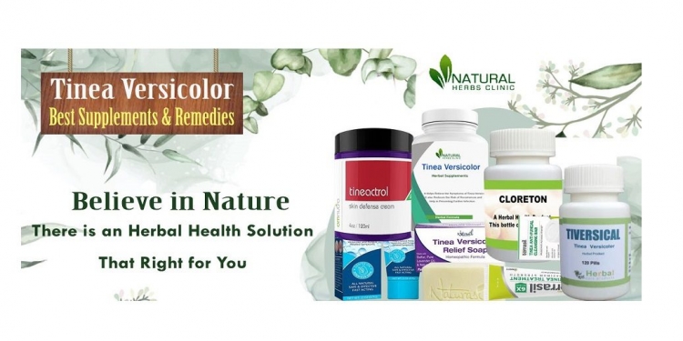 Natural Remedies for Tinea Versicolor