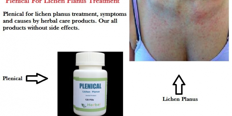 Plenical - Effective Lichen Planus Natural Treatment