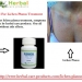 Plenical - Effective Lichen Planus Natural Treatment