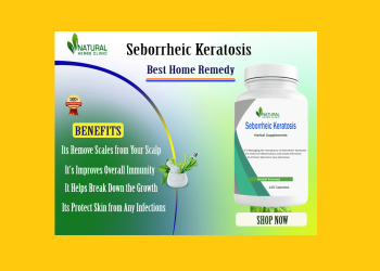 seborrheic keratosis natural treatments