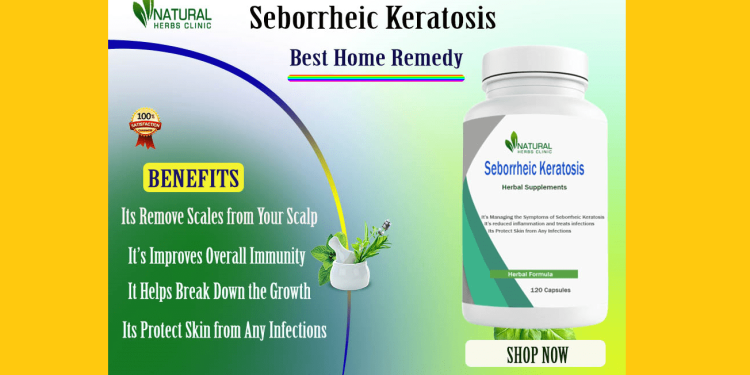 seborrheic keratosis natural treatments