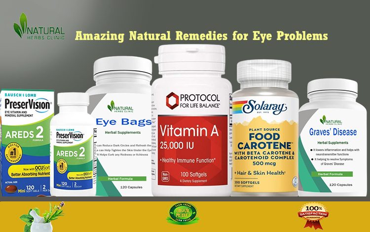 Amazing Natural Remedies for Eye Problems