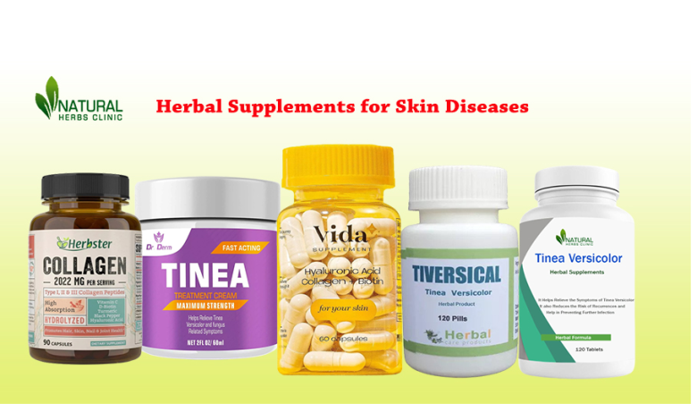 Herbal Supplement for Skin Diseases