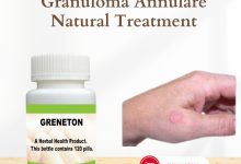 Natural Treatment for Granuloma Annulare