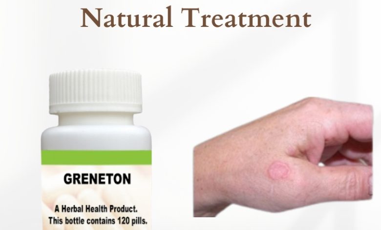 Natural Treatment for Granuloma Annulare