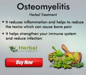 8 Natural Remedies for Bone and Joint Pain