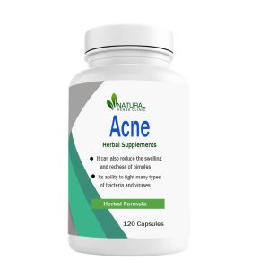Herbal Supplements fo Acne