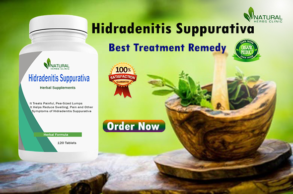 Hidradenitis Suppurativa Natural Remedies