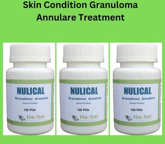 Skin Condition Granuloma Annulare Treatment
