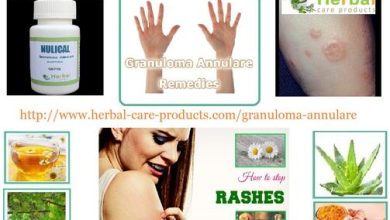 Herbal Remedies for Granuloma Annulare