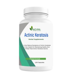Herbal-Supplements-fo-Actinic-Keratosis