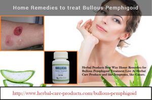 Herbal-Treatment-for-Bullous-Pemphigoid