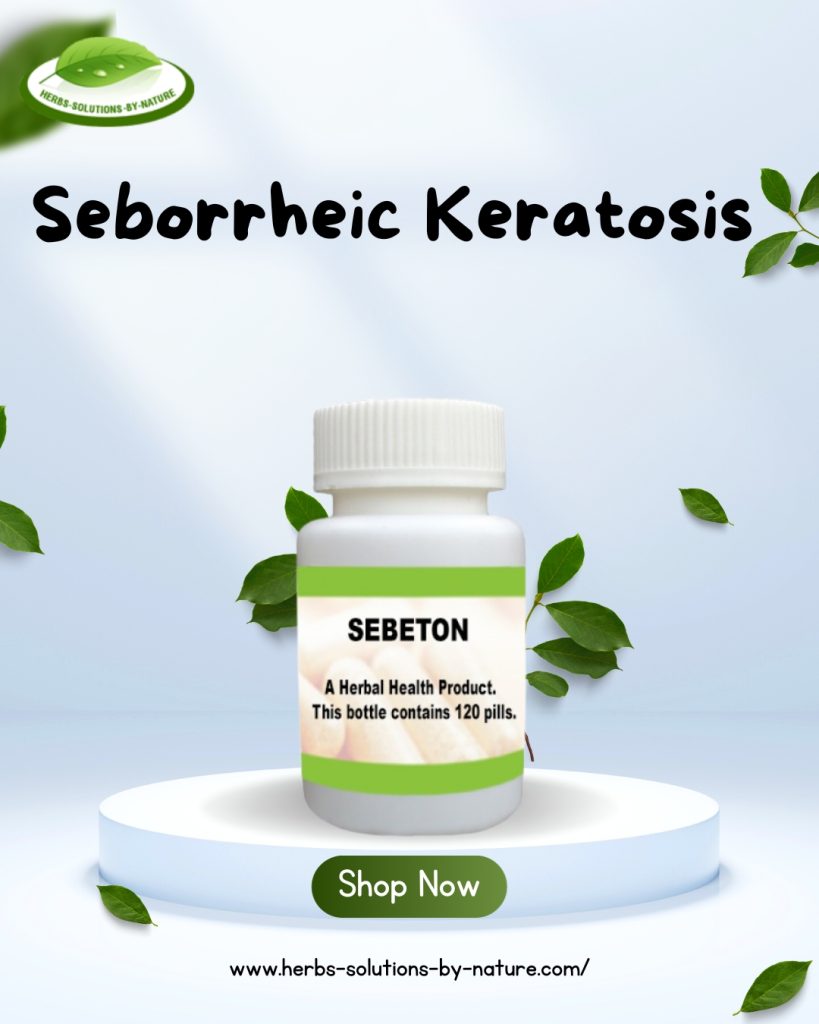 Castor Oil for Seborrheic Keratosis