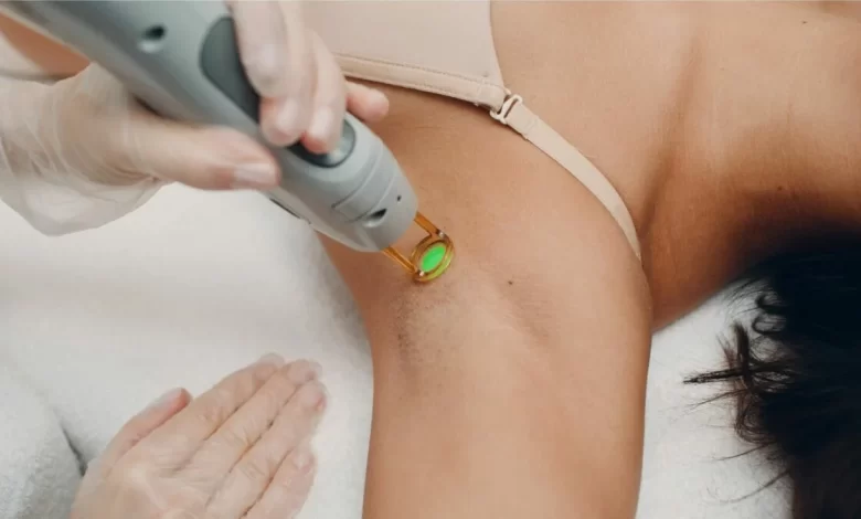 Does Laser Hair Removal Help Hidradenitis Suppurativa