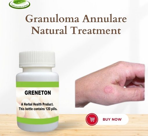 Granuloma Annulare Cancer