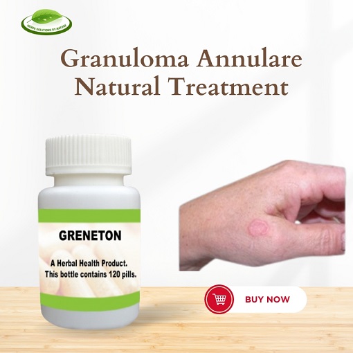 Granuloma Annulare Cancer