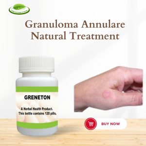 Granuloma Annulare Cancer
