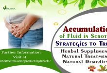Accumulation of Fluid in Scrotum