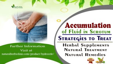 Accumulation of Fluid in Scrotum