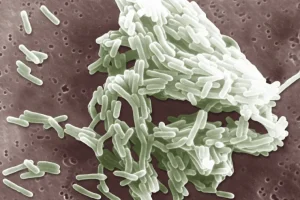 2 Dead in Listeria Outbreak Likely Linked to Sliced Deli Meats