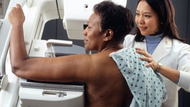 Double mastectomies do not improve breast cancer survival likelihood for most women, study finds