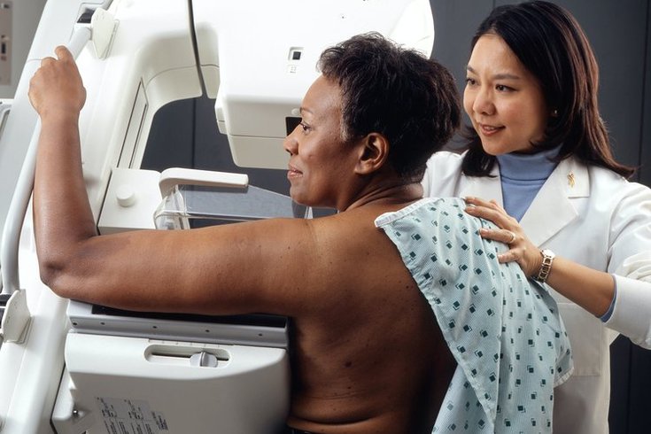 Double mastectomies do not improve breast cancer survival likelihood for most women, study finds