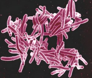 Woman who went on the lam with untreated TB is now cured