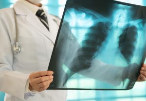 Cancer diagnosis delayed until the second year of the pandemic