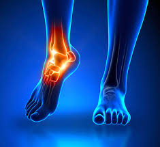 Injuries