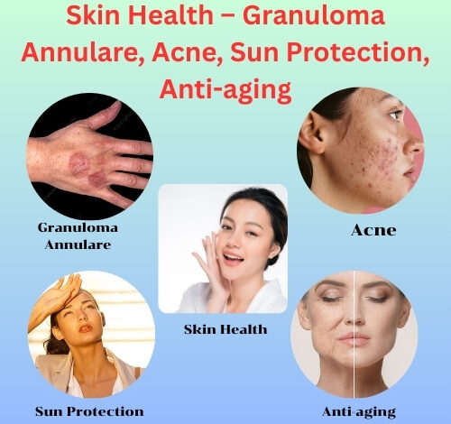 Skin Health – Granuloma Annulare, Acne, Sun Protection, Anti-aging