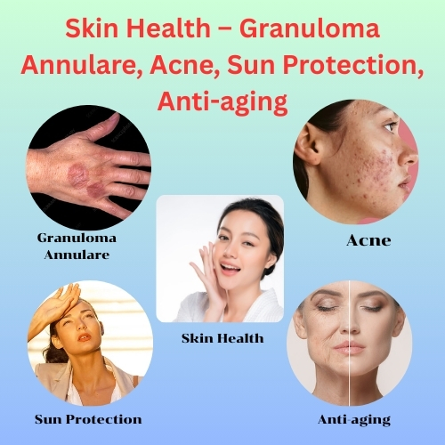 Skin Health – Granuloma Annulare, Acne, Sun Protection, Anti-aging