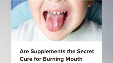 Are Supplements the Secret Cure for Burning Mouth Syndrome