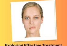 Exploring Effective Treatment Options for Myasthenia Gravis