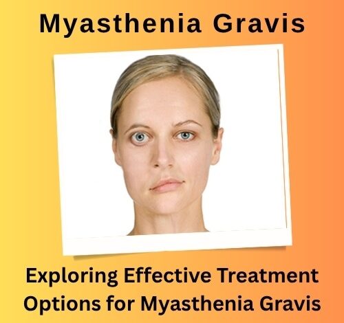 Exploring Effective Treatment Options for Myasthenia Gravis