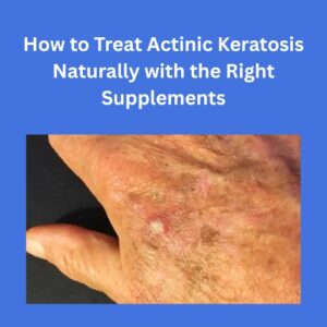 Buy Best Herbal Supplements Products and Natural Remedies