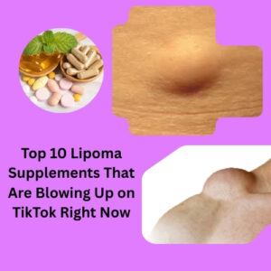 Top 10 Lipoma Supplements
