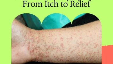 Top Supplements to Tackle Lichen Planus Symptoms