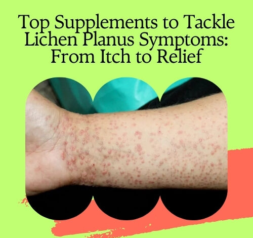 Top Supplements to Tackle Lichen Planus Symptoms