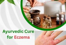Ayurvedic Cure for Eczema