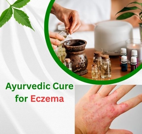Ayurvedic Cure for Eczema