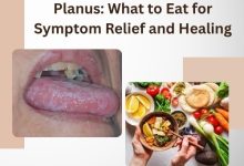 Best Diet for Oral Lichen Planus