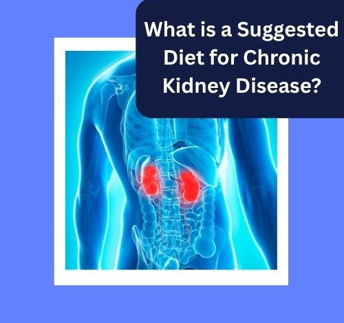 Diet for Chronic Kidney Disease