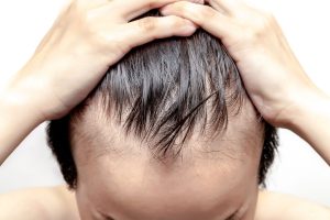 Does-Hair-Replacement-Have-Any-Side-Effects.jpg