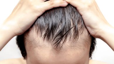 Does-Hair-Replacement-Have-Any-Side-Effects.jpg